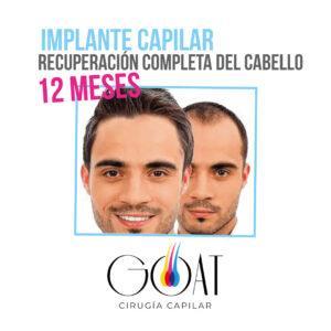gráfica placas para redes sociales idea tarjeta