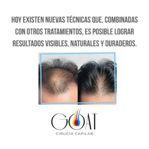gráfica placas para redes sociales idea tarjeta